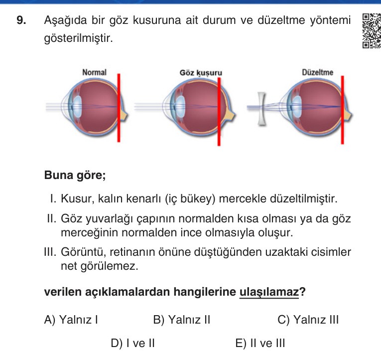 Gerçek Sınav Sorusu